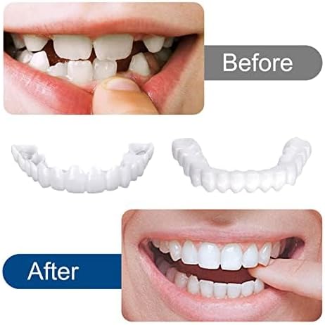 Instant Smile Reusable Snap On Veneers (Upper & Lower)