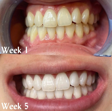 HiSmile – V34 Colour Corrector Serum